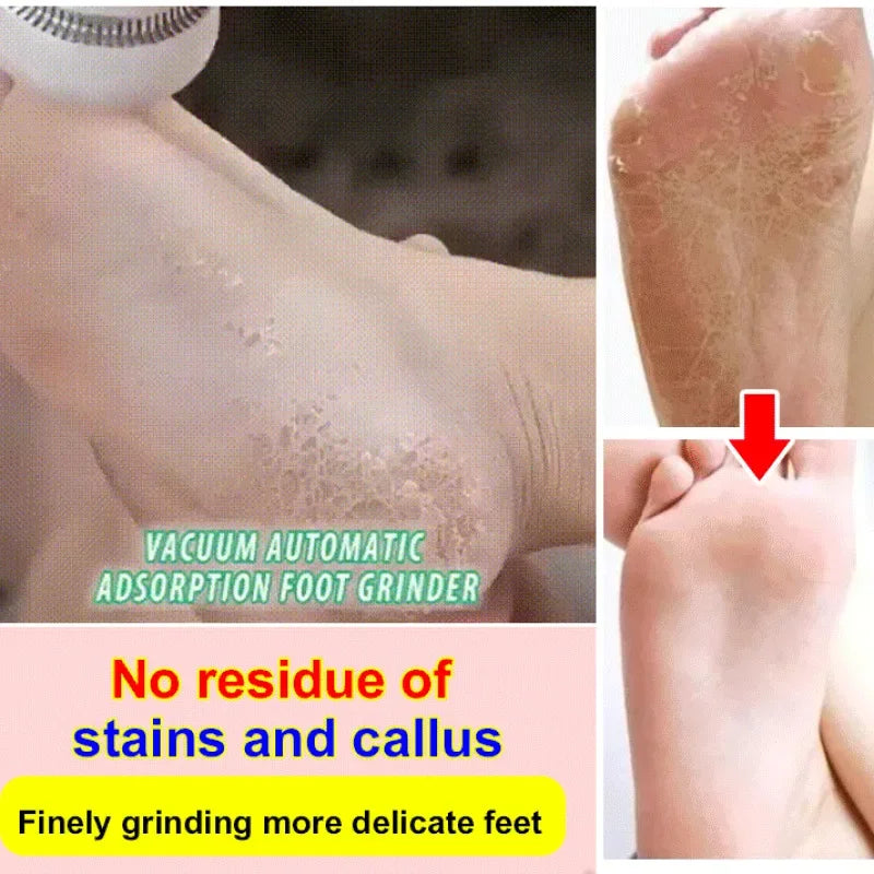 Electric Roller Foot File Grinder Electric Pedicure Machine Foot Grinder Pedicure Tools Foot Repair Machine Waterproof